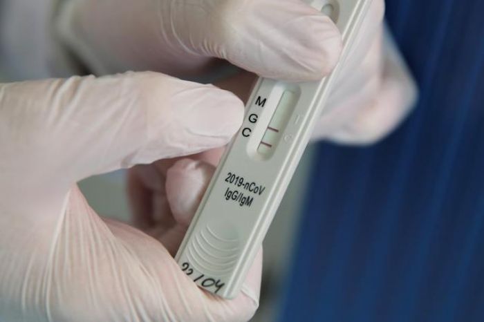 Pruebas para detectar Coronavirus