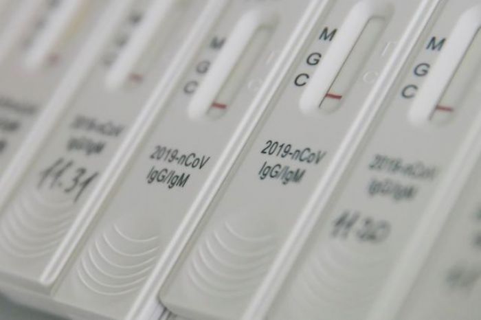 Detección de Coronavirus Covid-19